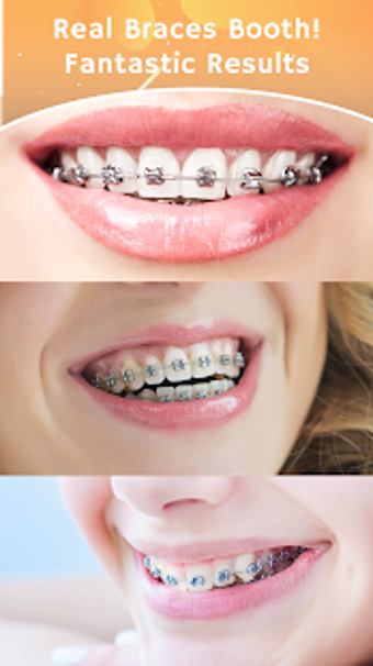 Imagen 3 para Teeth Braces Photo Maker-…