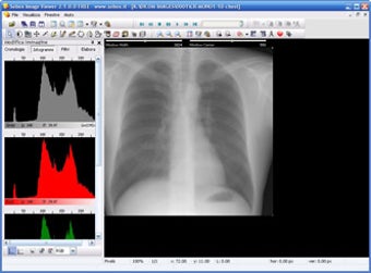 Image 0 for Sobox Image Viewer