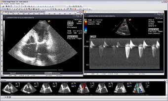 Image 2 for Sobox Image Viewer