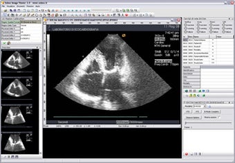 Image 3 for Sobox Image Viewer