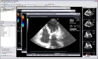 Image 1 for Sobox Image Viewer