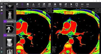Imagen 2 para StellarPACS DICOM Viewer …