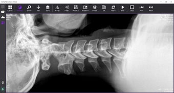 Imagen 3 para StellarPACS DICOM Viewer …