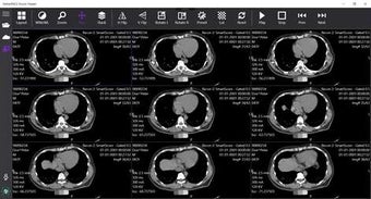 Imagen 0 para StellarPACS DICOM Viewer …