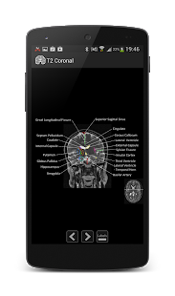 Imagen 3 para Atlas of MRI Brain Anatom…