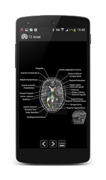 Imagen 1 para Atlas of MRI Brain Anatom…