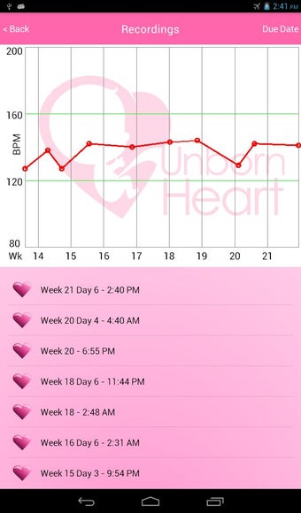 Imagen 1 para Fetal Doppler UnbornHeart