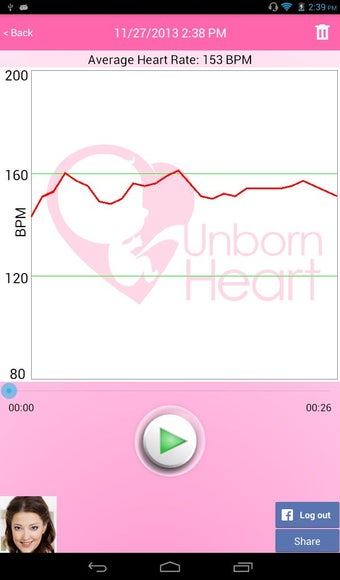 Imagen 4 para Fetal Doppler UnbornHeart
