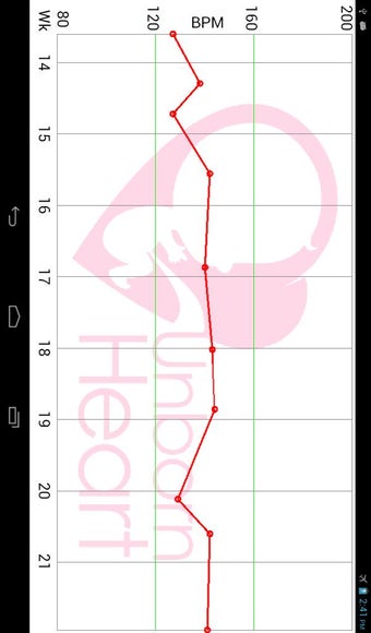 Imagen 0 para Fetal Doppler UnbornHeart
