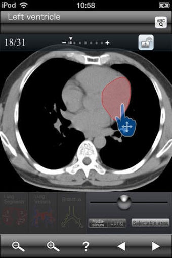 Image 0 for Chest CT Sectional Walker