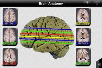 Image 7 for Brain Anatomy