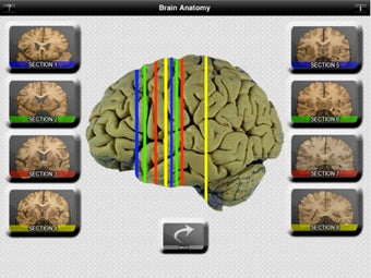 Image 2 for Brain Anatomy