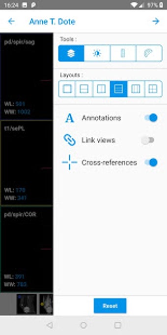 Image 2 for IMAIOS Dicom Viewer