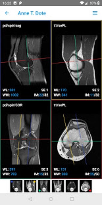 Image 3 for IMAIOS Dicom Viewer