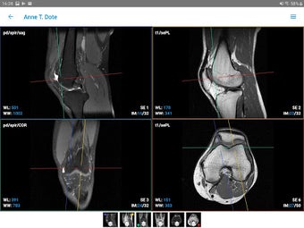 Image 1 for IMAIOS Dicom Viewer