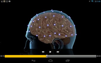 Imagen 6 para Neurology & Psychiatry - …