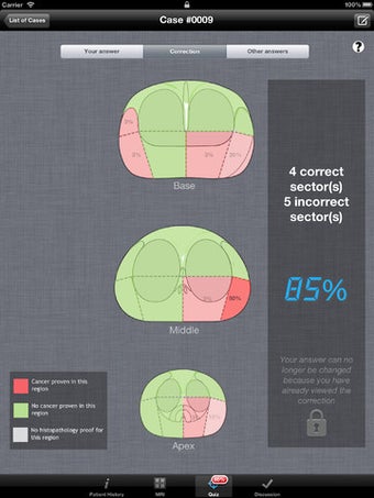 Image 0 for Prostate Cancer Imaging L…
