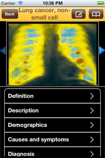 Image 0 for Encyclopedia of Cancer