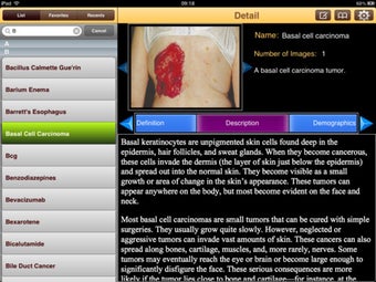 Image 6 for Encyclopedia of Cancer