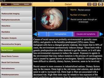 Image 1 for Encyclopedia of Cancer