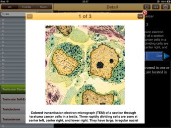 Image 3 for Encyclopedia of Cancer