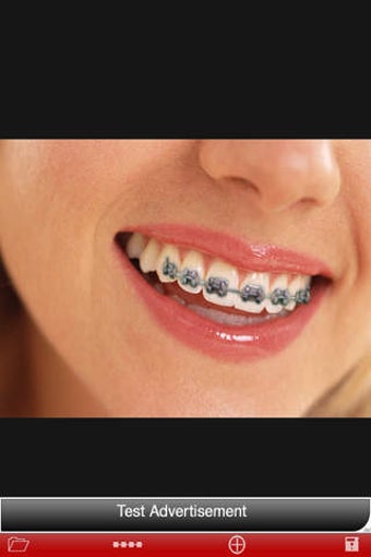 Image 0 for Orthodontic