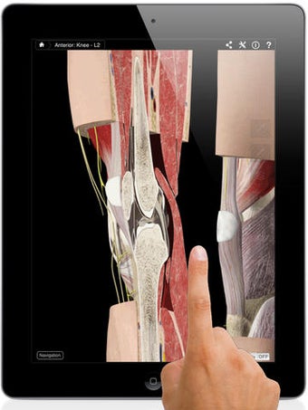 Image 0 for Knee Pro III with Animati…