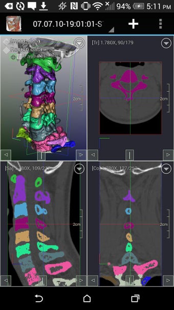 Imagen 2 para DroidRender - 3D DICOM vi…
