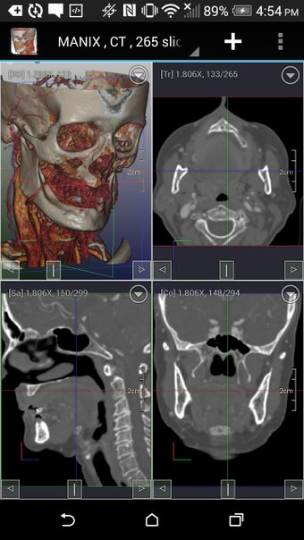 Imagen 0 para DroidRender - 3D DICOM vi…