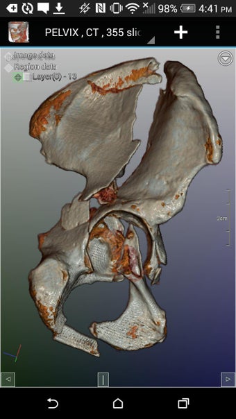 Imagen 1 para DroidRender - 3D DICOM vi…