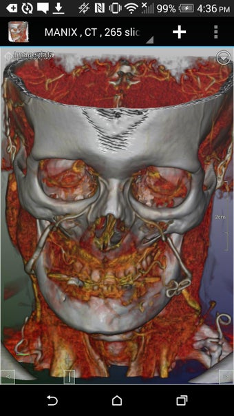 Imagen 3 para DroidRender - 3D DICOM vi…