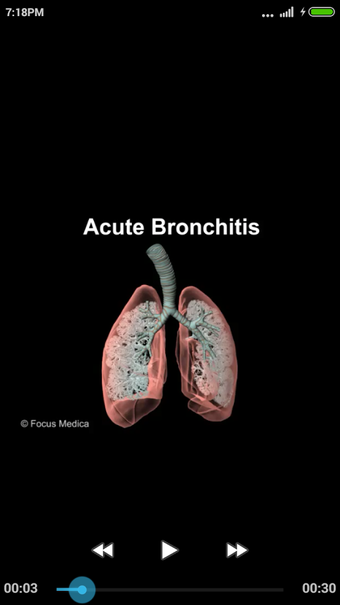 Imagen 7 para Respiratory Diseases - Di…