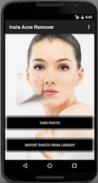Image 3 for Face Acne Remover Photo E…