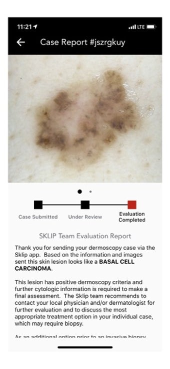 Image 0 for SKLIP