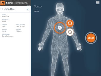 Image 1 for SpinalTech3D Scan