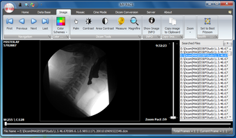 Image 0 for Fadonics My PACS (32 bit)