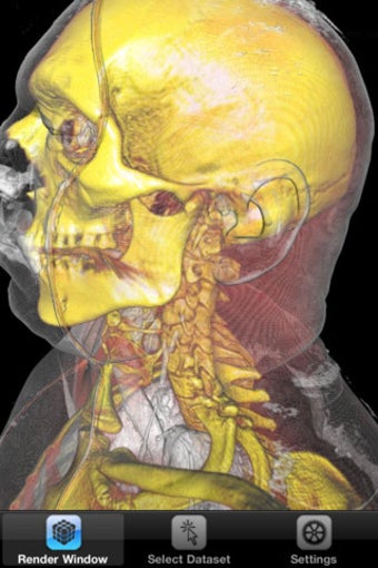 Imagen 0 para ImageVis3D Mobile Univers…