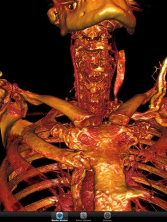 Imagen 1 para ImageVis3D Mobile Univers…