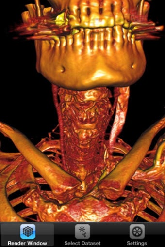 Imagen 5 para ImageVis3D Mobile Univers…