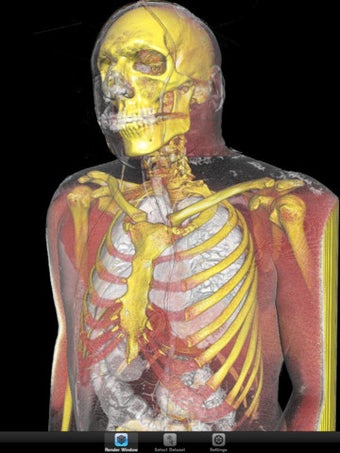 Imagen 2 para ImageVis3D Mobile Univers…