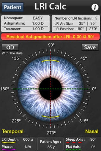 Image 0 for LRI Calc - Limbal Relaxin…