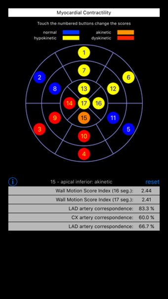 Image 0 for Wall Motion Score Index