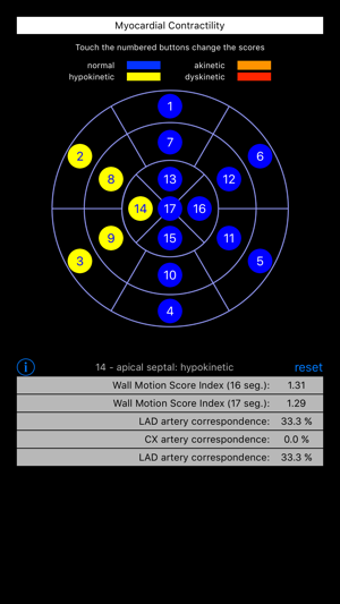 Image 2 for Wall Motion Score Index