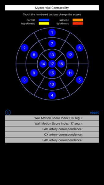 Image 3 for Wall Motion Score Index