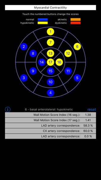 Image 1 for Wall Motion Score Index