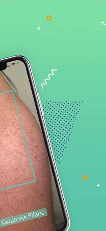 Image 2 for Rash ID