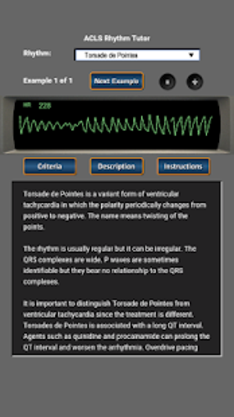 Image 0 for ACLS Rhythm Tutor