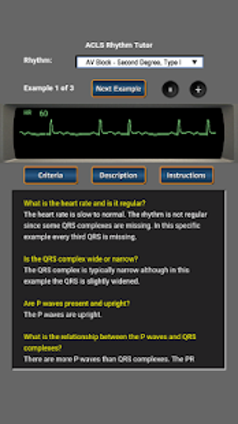 Image 1 for ACLS Rhythm Tutor