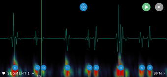 Image 1 for Steth IO