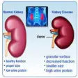Icon of program: All kidney diseases and T…